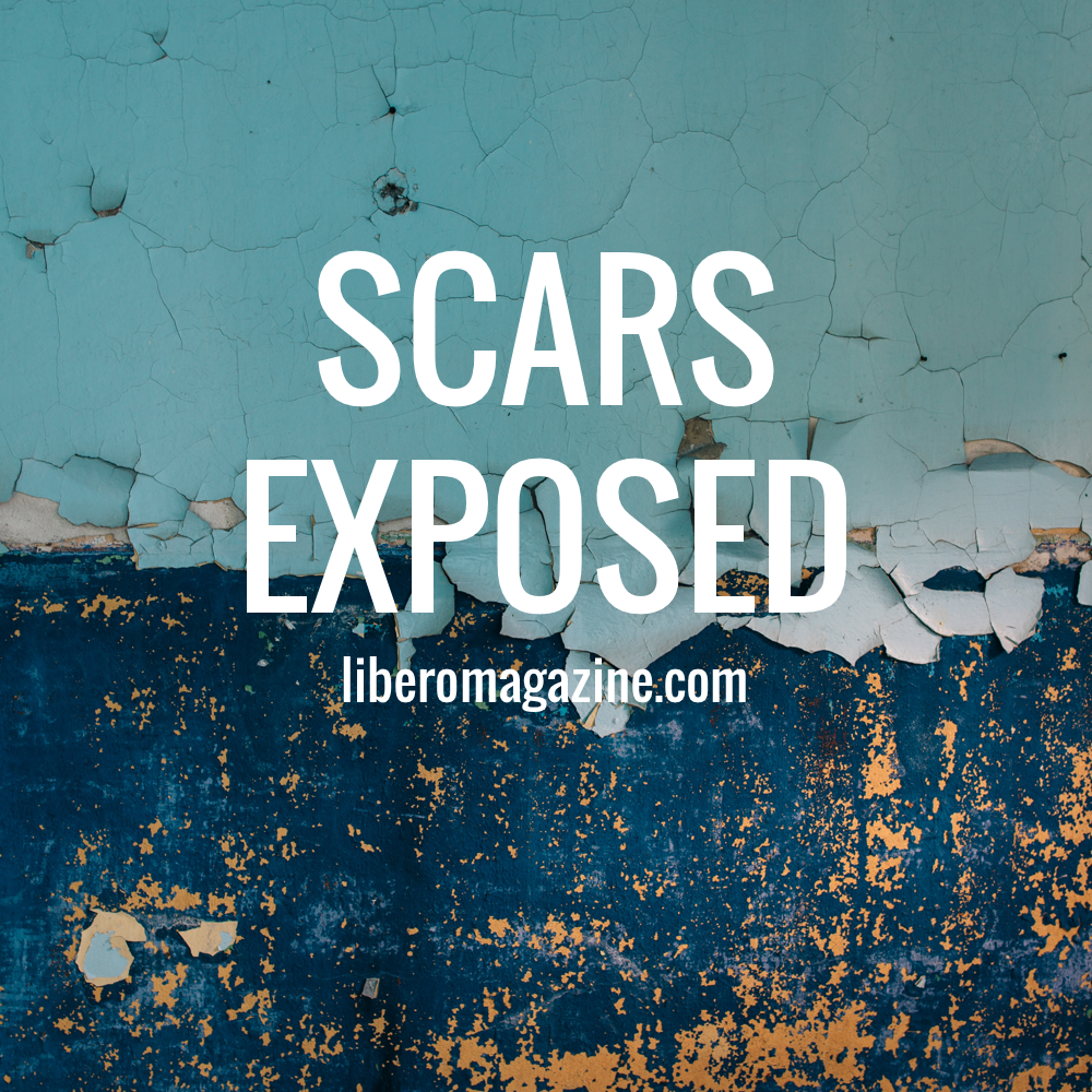 Scars Exposed | Libero Magazine